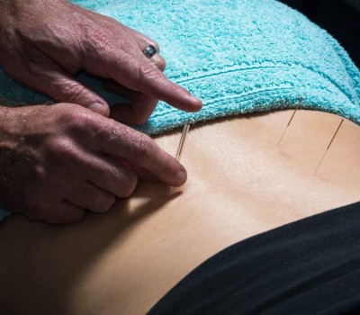 dryneedling